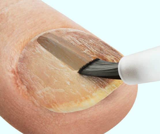 RSL_Designs_Tinexyl_Pro_Features